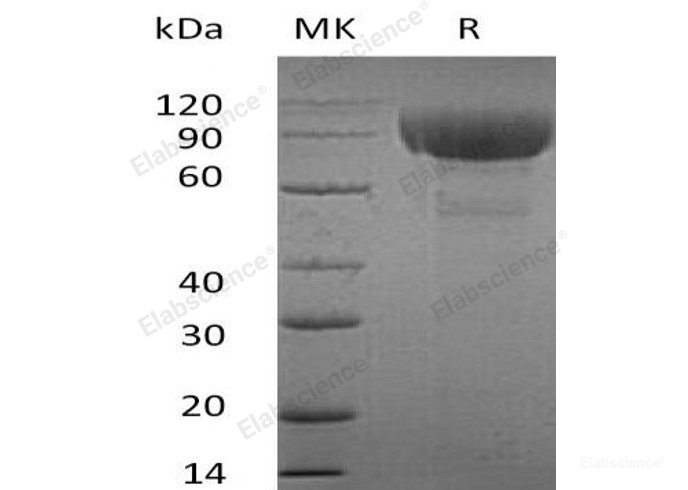 Recombinant Human IL-1 Receptor-Like 2/IL-1RL2 Protein(C-Fc)-Elabscience