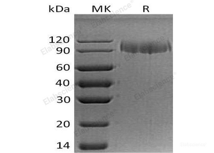 Recombinant Human Integrin α-5/ITGA5 Protein(C-6His)-Elabscience