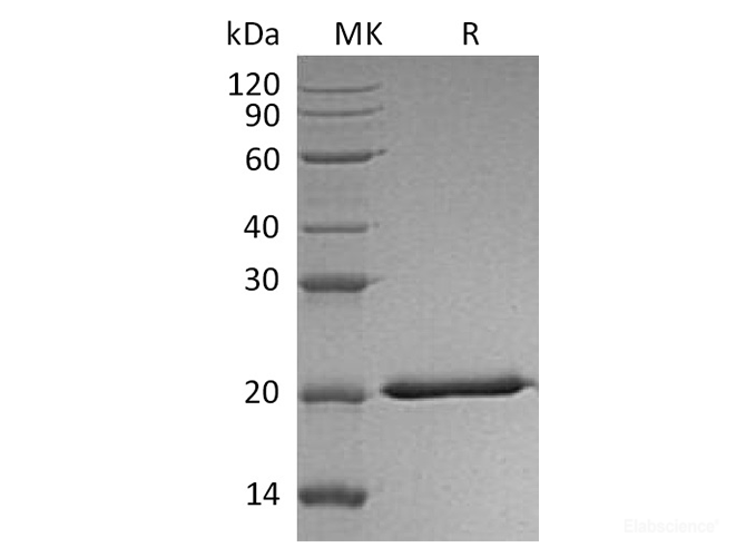 Recombinant Human Interferon Lambda-2/IL-28A Protein(C-6His)-Elabscience