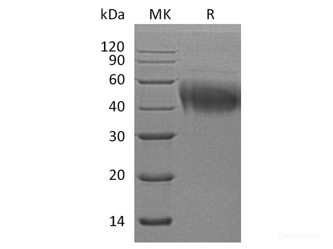 Recombinant Human Interleukin-4 Receptor Subunit Alpha/IL-4 Rα Protein(C-6His)-Elabscience