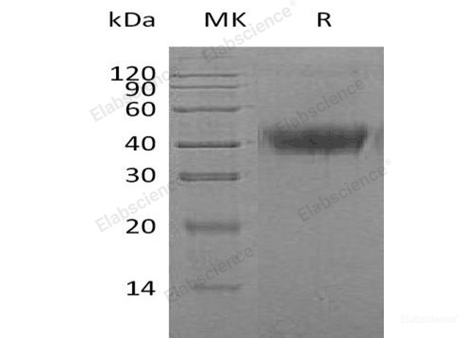 Recombinant Human M-CSF/CSF1 Protein(C-6His)-Elabscience