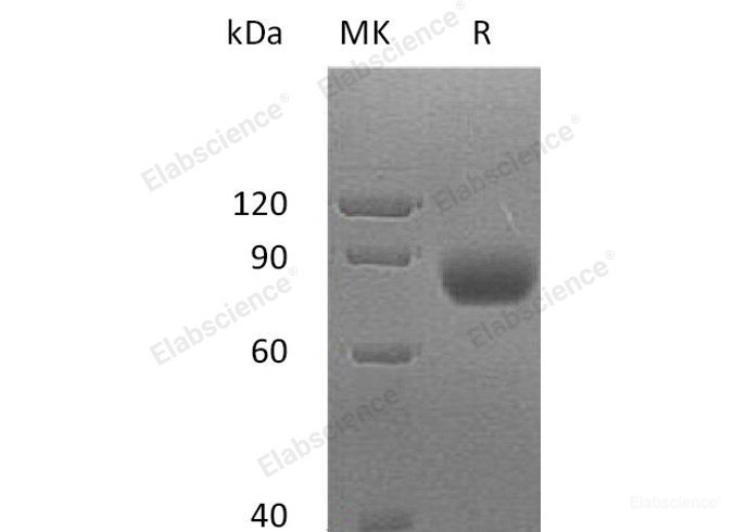 Recombinant Human MHC Class I Polypeptide-Related Sequence A/MICA Protein(C-Fc)-Elabscience