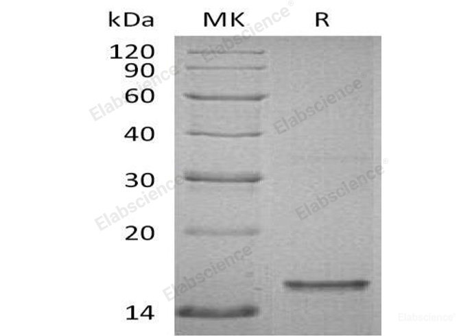 Recombinant Human Microtubule-Associated Protein Tau/MAPT-D/Tau-D Protein(C-6His)-Elabscience