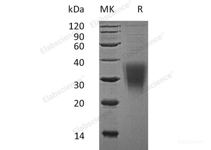 Recombinant Human NKG2-A/NKG2-B Type II Integral Membrane Protein Protein(N-8His)-Elabscience