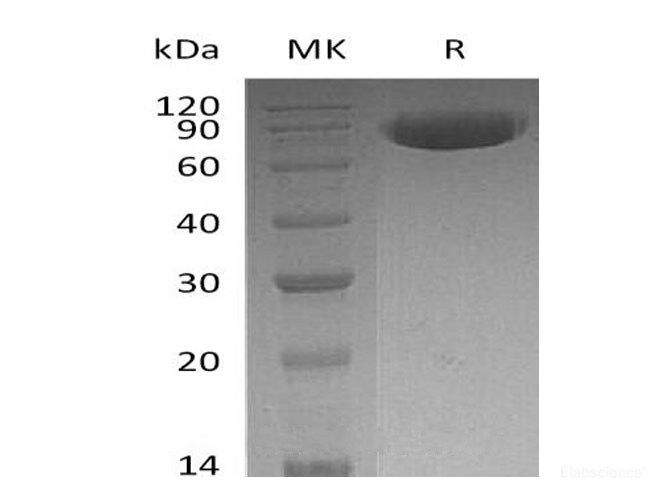 Recombinant Human OX-2/MOX1/CD200 Protein(C-Fc)-Elabscience