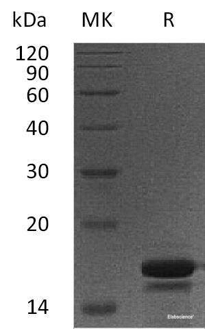 Recombinant Human PDCD5/TFAR19 Protein(N-6His)-Elabscience