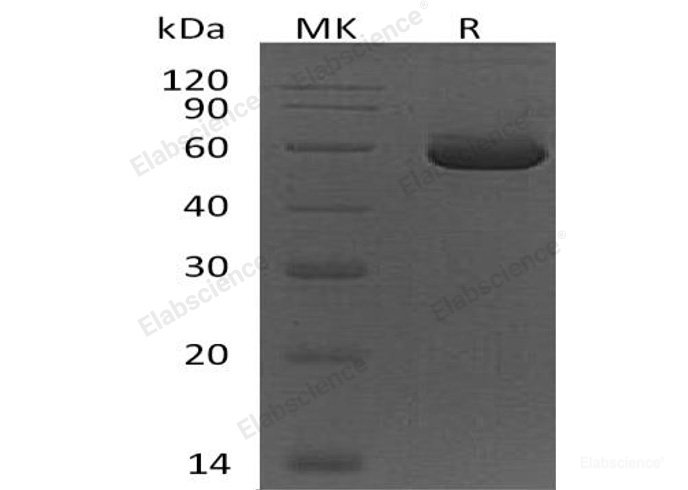 Recombinant Human Peptidase D/PEPD Protein-Elabscience
