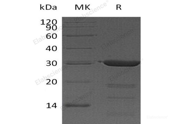Recombinant Human Peptidyl-Prolyl Cis-Trans Isomerase FKBP3 Protein(N-6His)-Elabscience