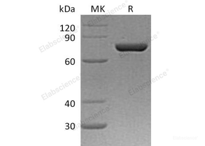 Recombinant Human Protein Disulfide-Isomerase A4/PDIA4 Protein(C-6His)-Elabscience
