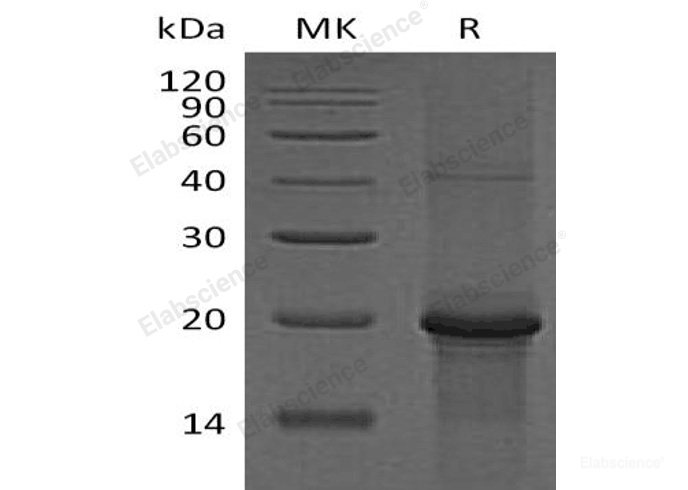 Recombinant Human Protein Kinase C Type ε/PKC ε/PKCE Protein(C-6His)-Elabscience