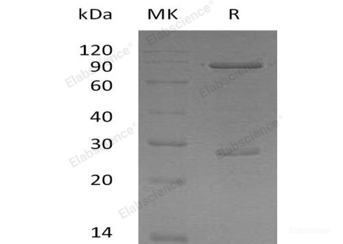 Recombinant Human SMAD Family Member 1/SMAD1 Protein(N-GST)-Elabscience