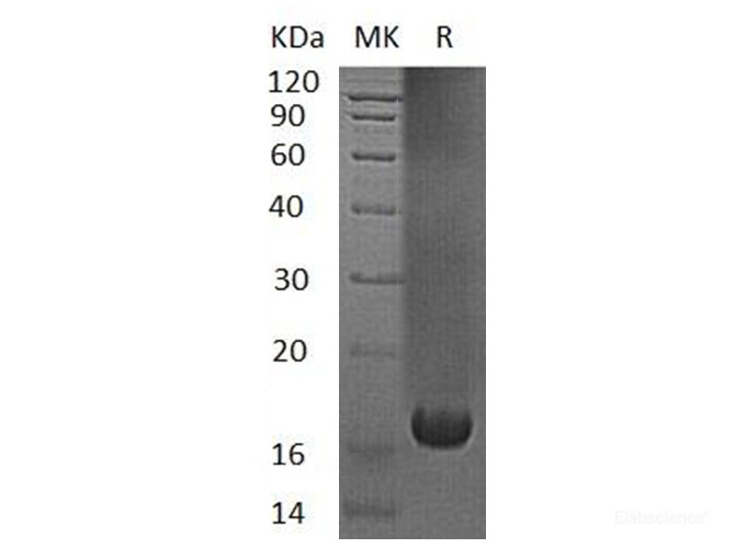 Recombinant Human Ubiquitin-Conjugating Enzyme E2 Variant 1/UBE2V1 Protein(C-6His)-Elabscience