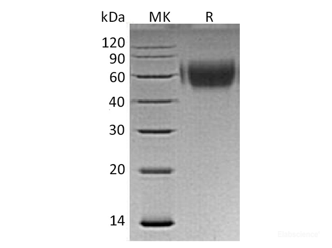 Recombinant Human MHC Class I Polypeptide-Related Sequence A Protein-Elabscience