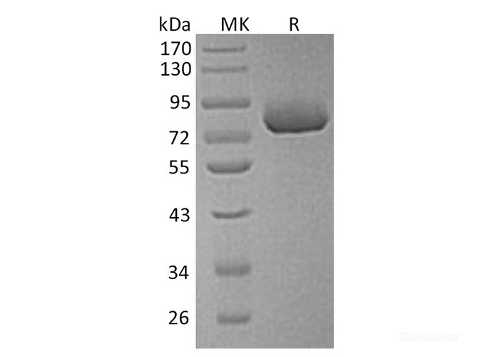 Recombinant Human Xaa-Pro Aminopeptidase 2 Protein-Elabscience