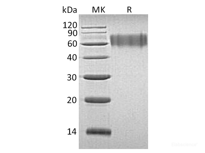 Recombinant Human Ly6/PLAUR Domain-Containing Protein 3 Protein-Elabscience