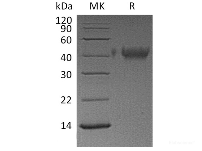 Recombinant Human TIM-3 / HAVCR2 Protein (C-His)-Elabscience