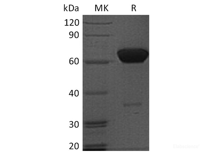 Recombinant Human PDCD1 / PD-1 / CD279 Protein (C-Fc)-Elabscience