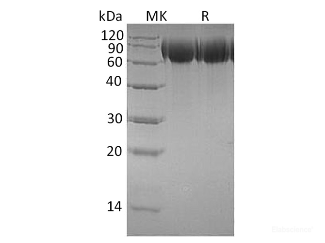 Recombinant Human TrkB / NTRK2 Protein (C-His)-Elabscience