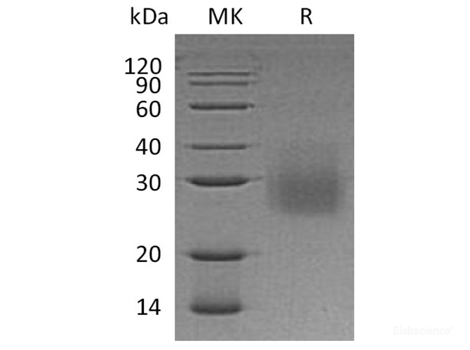 Recombinant Human HVEM / TNFRSF14 Protein (C-His)-Elabscience