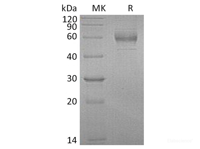 Recombinant Human GFRA1 / GFRα1 / GDNFRA Protein (C-His)-Elabscience