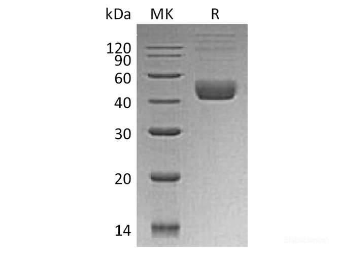 Recombinant Human CTLA4 / CD152 Protein (C-GST)-Elabscience