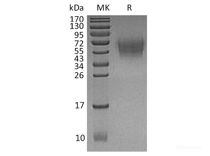 Recombinant Human CD226 Antigen / DNAM-1 / CD226 Protein (C-His)-Elabscience
