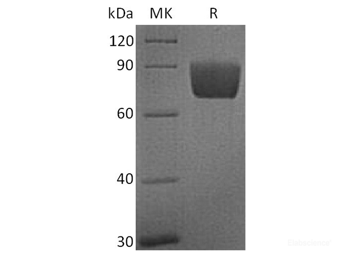 Recombinant Human B7-H4 / VTCN1 Protein (C-Fc)-Elabscience