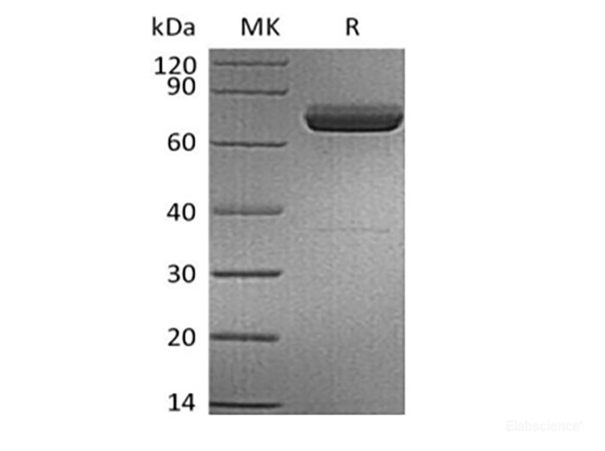 Recombinant Human IL-23 alpha & Mouse IL-12 beta Heterodimer (C-6His)