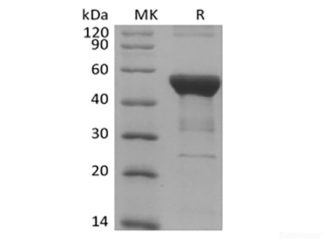 Recombinant Human NFKB1 (N-6His)