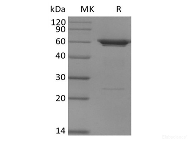 Recombinant Human PFKFB3 (N-6His)
