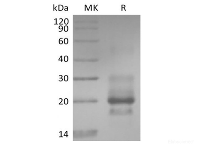 Recombinant Human TRAIL R1 / DR4 / TNFRSF10A (C-6His）
