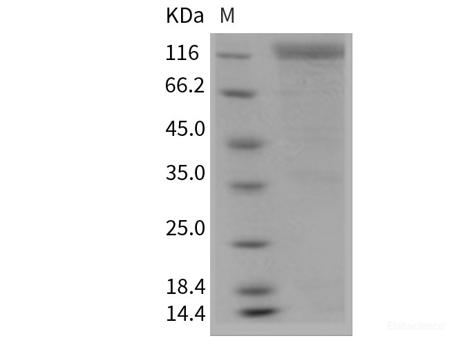 Recombinant Mouse HER2 / ErbB2 Protein (Fc tag)-Elabscience