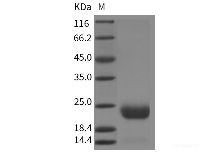 Recombinant Mouse CCDC47 Protein (His Tag)-Elabscience