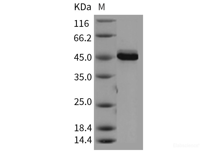 Recombinant Mouse AKT3 Protein (aa 106-479)-Elabscience