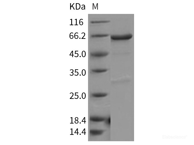 Recombinant Mouse PDK4 Protein (His & GST tag)-Elabscience