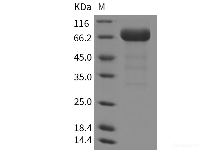 Recombinant Mouse EphA3 Protein (His tag)-Elabscience