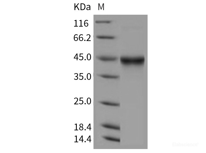Recombinant Mouse IL5Ra / CD125 Protein (His tag)-Elabscience
