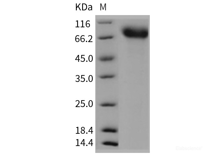Recombinant Mouse TrkA / NTRK1 Protein (His tag)-Elabscience
