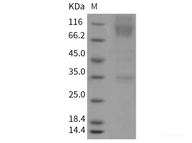 Recombinant Mouse SIRP alpha / CD172a Protein (Fc tag)-Elabscience