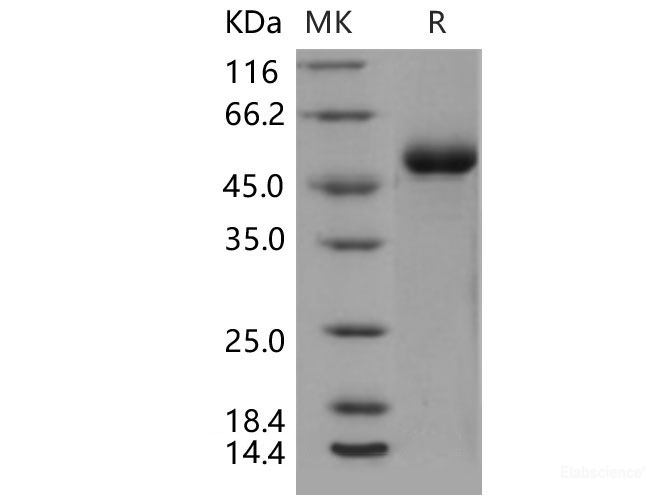 Recombinant Mouse DDR1 Kinase / MCK10 / CD167 Protein (His tag)-Elabscience