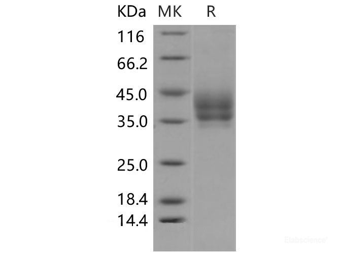 Recombinant Mouse B7-DC / PD-L2 / CD273 Protein (His tag)-Elabscience