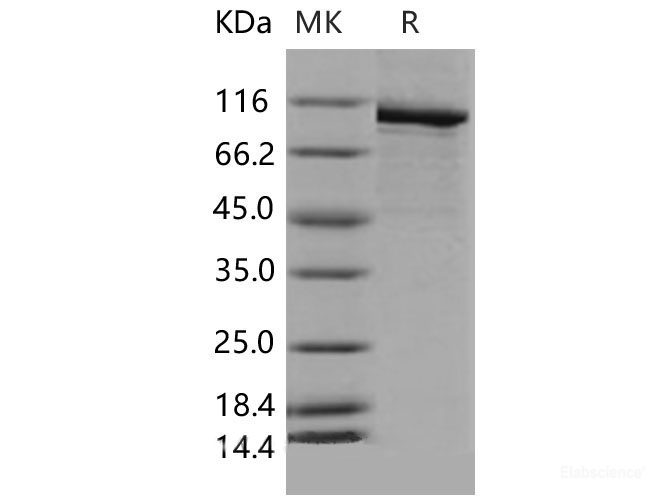 Recombinant Mouse PARP-1 / PARP Protein (His tag)-Elabscience