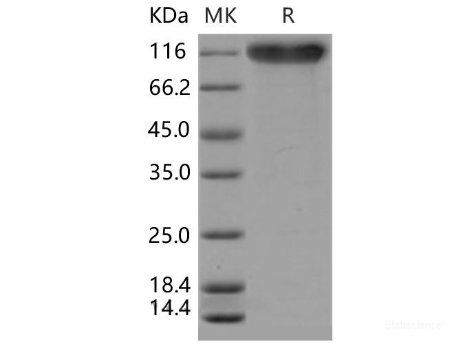 Recombinant Mouse SELP / selectin P / P-selectin Protein (His tag)-Elabscience