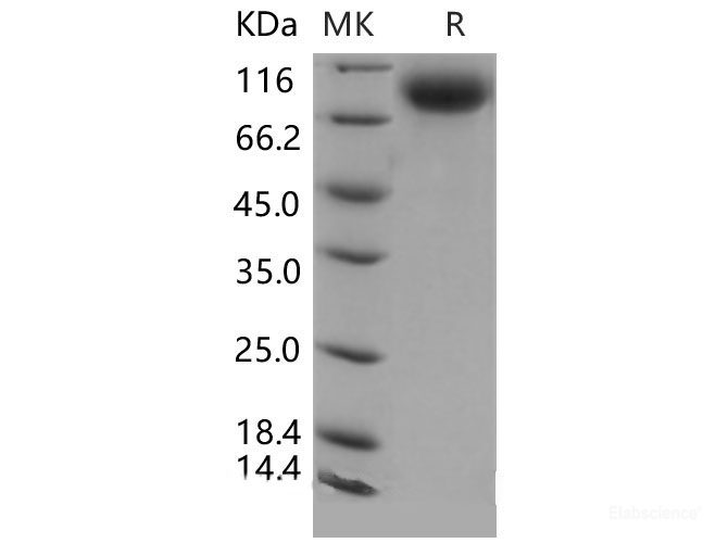 Recombinant Mouse E-Selectin / CD62e / SELE Protein (His tag)-Elabscience