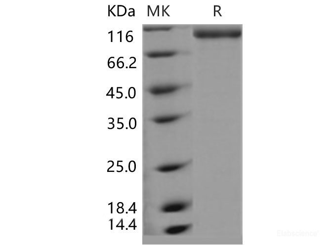 Recombinant Mouse E-Selectin / CD62e / SELE Protein (Fc tag)-Elabscience