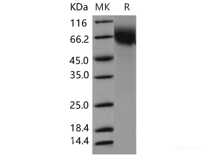 Recombinant Mouse CD6 / TP120 Protein (His tag)-Elabscience
