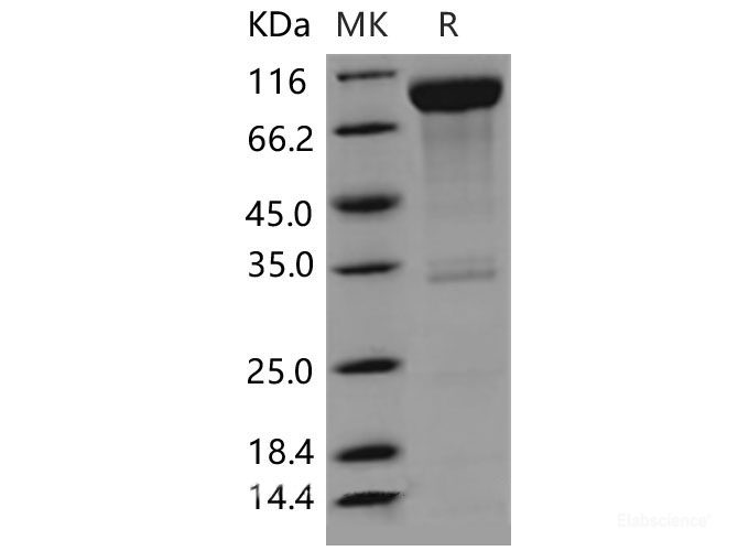 Recombinant Mouse CD6 / TP120 Protein (Fc tag)-Elabscience