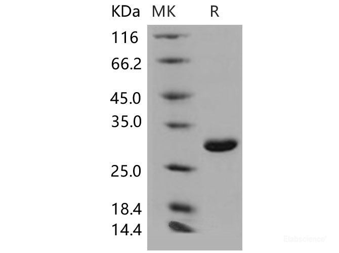 Recombinant Mouse UCHL1 / PGP9.5 Protein (His tag)-Elabscience