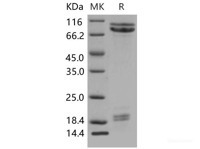 Recombinant Mouse E-Cadherin / CDH1 / E-cad / CD324 Protein (His tag)-Elabscience