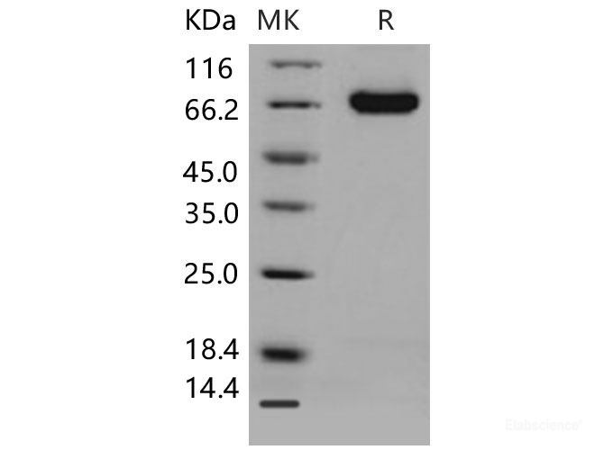 Recombinant Mouse DLL4 / Delta4 Protein (His tag)-Elabscience